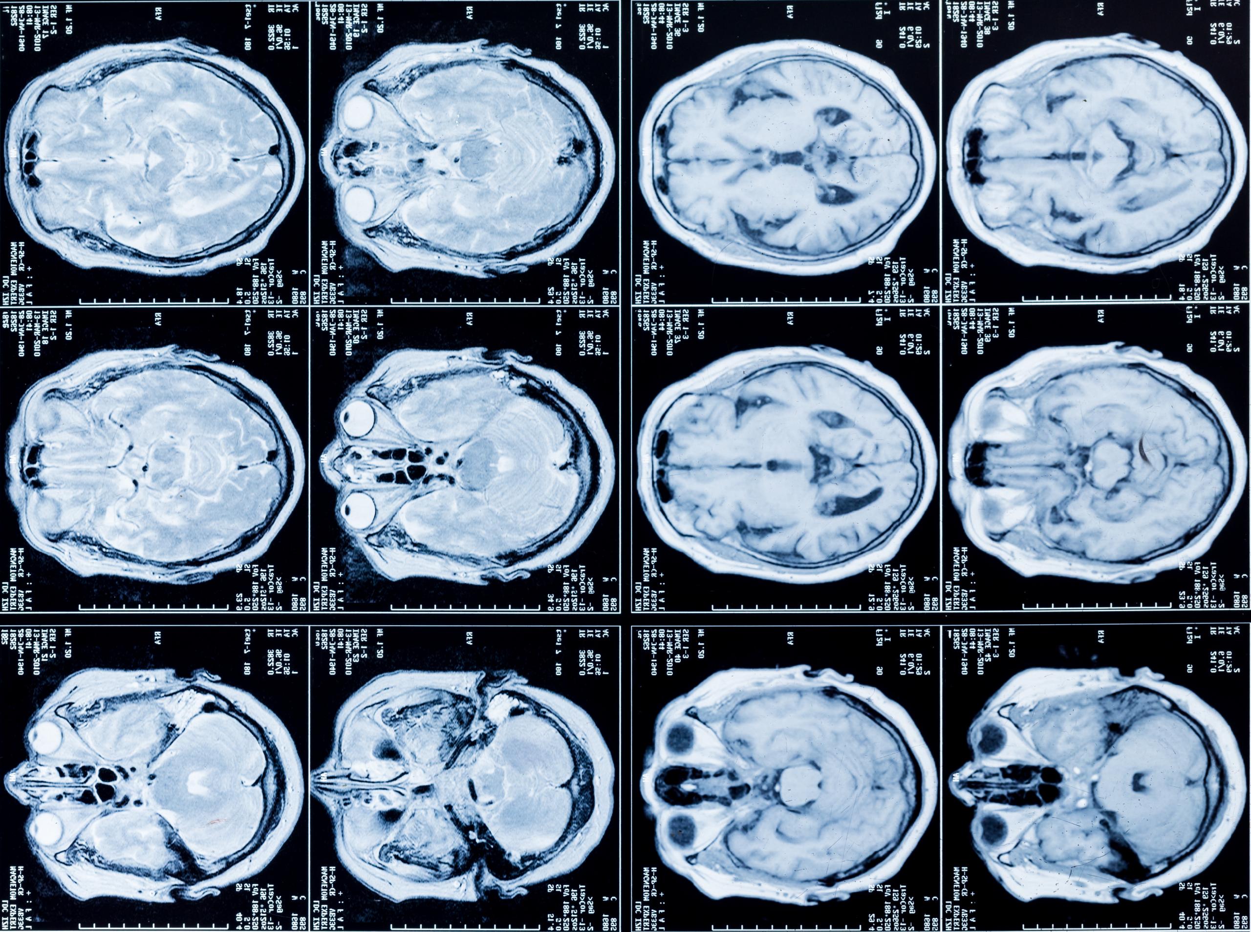 Neurology and Neurosurgery Services in Doral—Viva Medical Center